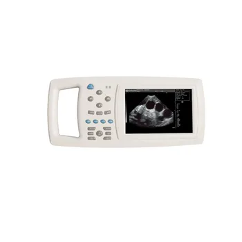 Ultragarso, Optinės, Elektroninės Įrangos Nešiojamas ultragarsinis tyrimas nėštumo su balta ir juoda B režimu ecografo vacunosOther U